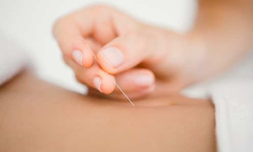 World Acupuncture Day 2018!